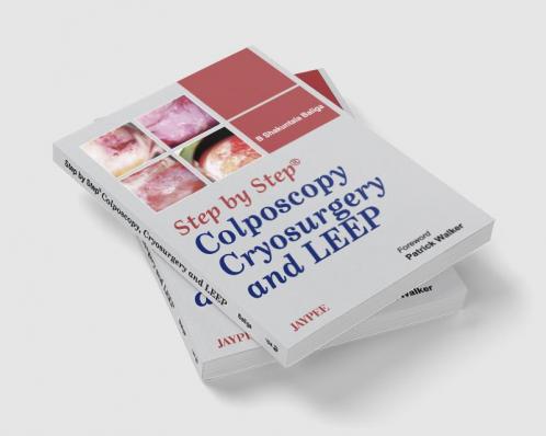STEP BY STEP COLPOSCOPY CRYOSURGERY AND LEEP WITH DVD-ROM
