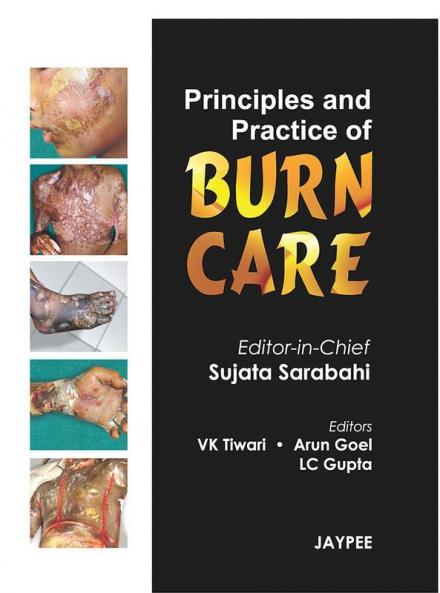 PRINCIPLES AND PRACTICE OF BURN CARE