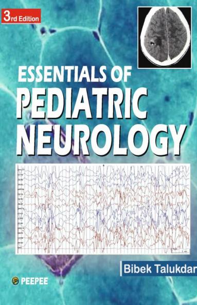 Essentials of Pediatric Neurology