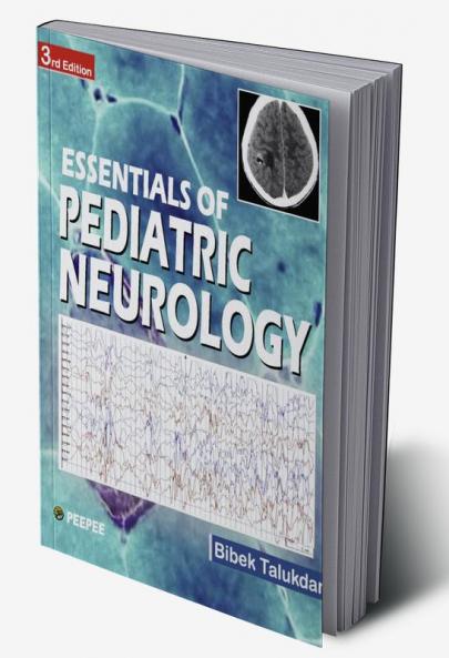 Essentials of Pediatric Neurology