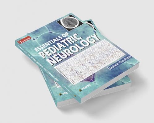 Essentials of Pediatric Neurology