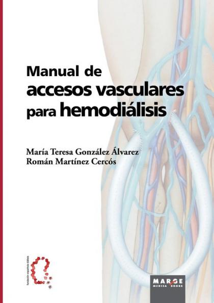 Manual De Accesos Vasculares Para Hemodiálisis (Spanish Edition)
