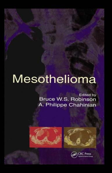 Mesothelioma