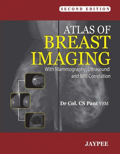 Atlas of Breast Imaging with Mammography Ultrasound and MRI Correlation