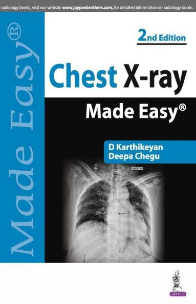Chest X-ray Made Easy 2nd edn 2017