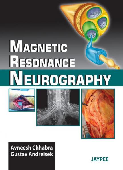 Magnetic Resonance Neurography (POD)