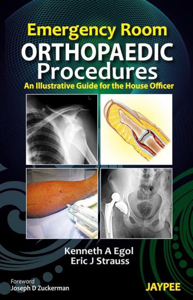 Emergency Room Orthopaedic Procedures :An Illustrative Guide For The House Officer