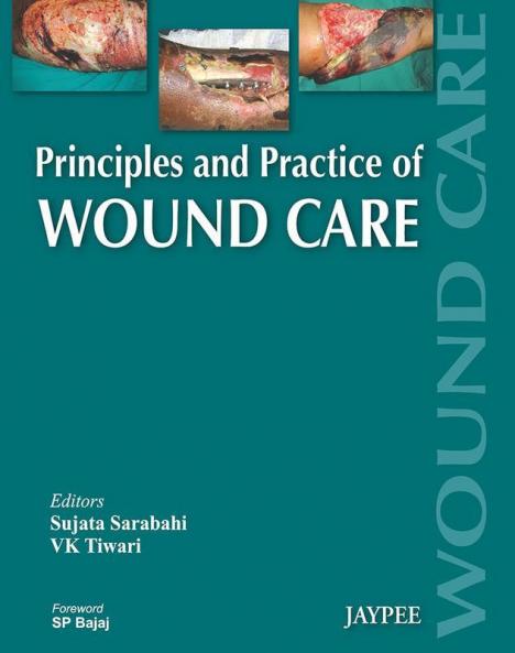 PRINCIPLES AND PRACTICE OF WOUND CARE