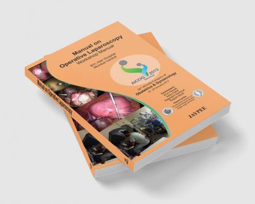 Manual On Operative Laparoscopy Workshop Manual Aicog 2013