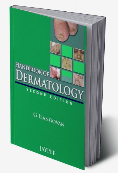 HANDBOOK OF DERMATOLOGY