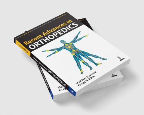 RECENT ADVANCES IN ORTHOPEDICS