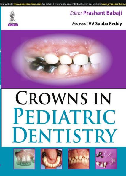 CROWNS IN PEDIATRIC DENTISTRY
