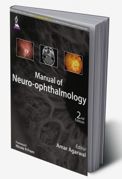 MANUAL OF NEURO-OPHTHALMOLOGY