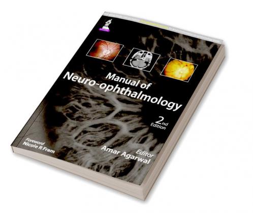 MANUAL OF NEURO-OPHTHALMOLOGY