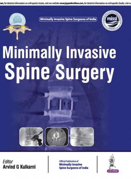 Minimally Invasive Spine Surgery