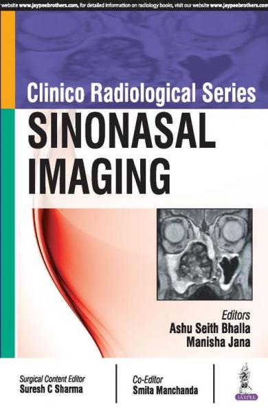 Clinico Radioloical Series: Sinonasal Imaging