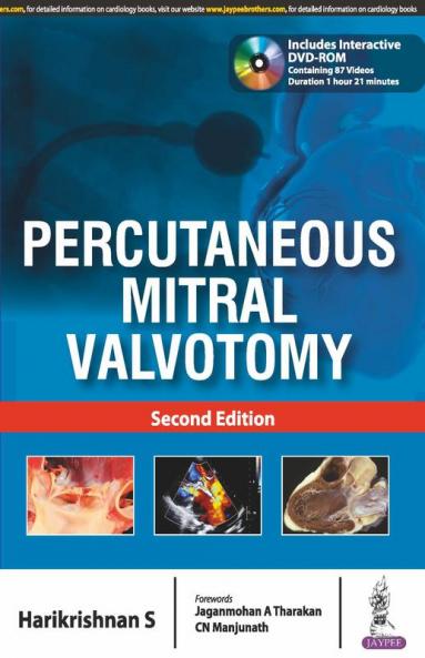 PERCUTANEOUS MITRAL VALVOTOMY