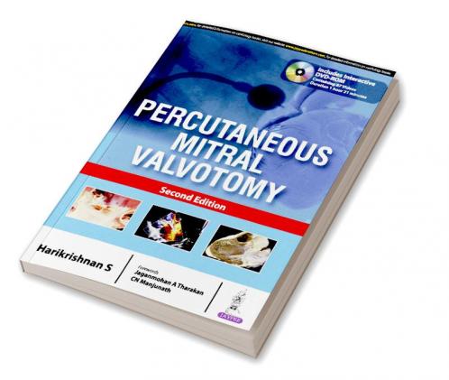 PERCUTANEOUS MITRAL VALVOTOMY