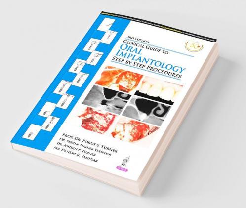 CLINICAL GUIDE TO ORAL IMPLANTOLOGY:STEP BY STEP PROCEDURES