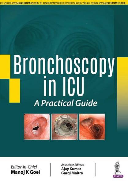 BRONCHOSCOPY IN ICU: A PRACTICAL GUIDE
