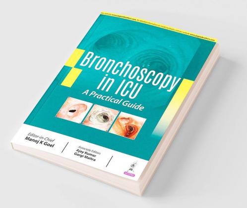 BRONCHOSCOPY IN ICU: A PRACTICAL GUIDE