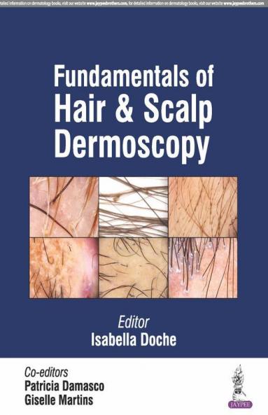 FUNDAMENTALS OF HAIR & SCALP DERMOSCOPY