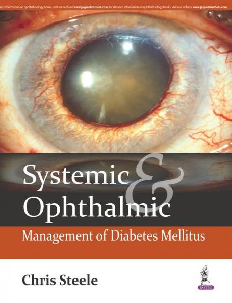 Systemic & Ophthalmic Management of Diabetes Mellitus