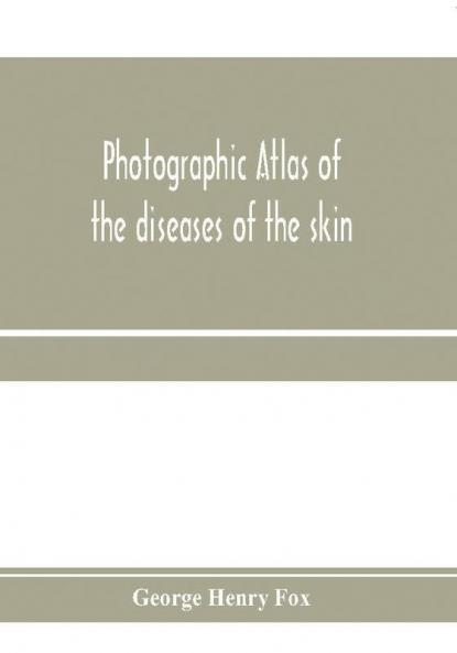 Photographic atlas of the diseases of the skin; A Series of Eighty Plates Comprising more than One Hundred Illustrations with Descriptive text and a Treatise on Cutaneous Therapeutics