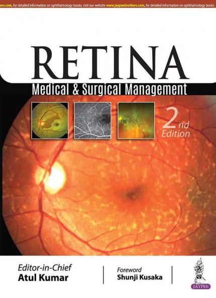 Retina: Medical & Surgical Management