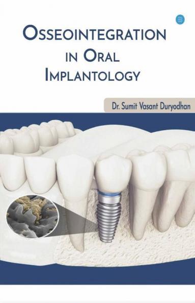 Osseointegration In Oral Implantology