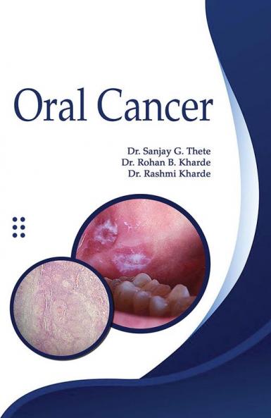 ORAL CANCER