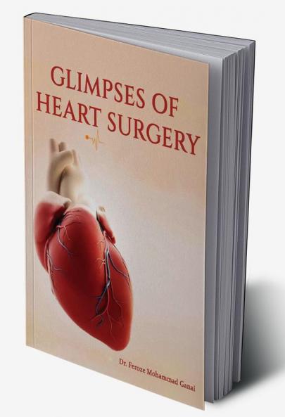 GLIMPSES OF HEART SURGERY