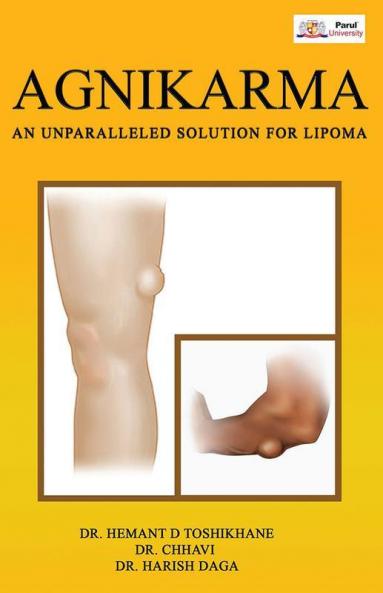 Agnikarma  An Unparalleled Solution For Lipoma