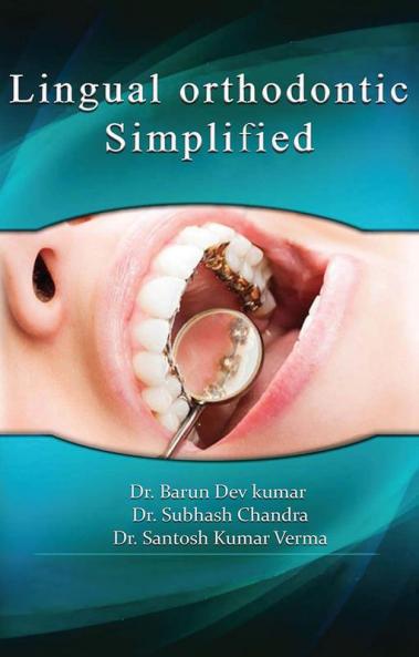 LINGUAL ORTHODONTIC SIMPLIFIED