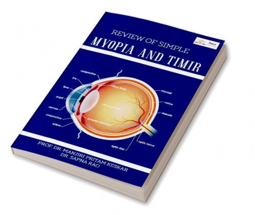 REVIEW OF SIMPLE MYOPIA AND TIMIR