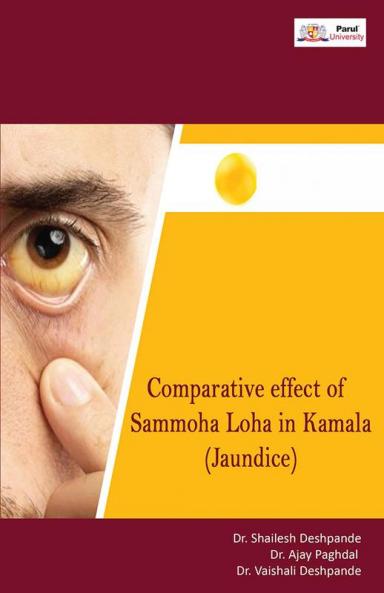 Comparitive Effect of Sammoha Loha Vati in Kamala (Jaundice)