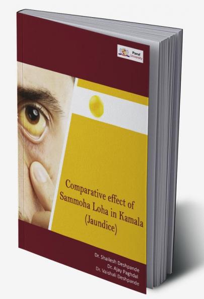 Comparitive Effect of Sammoha Loha Vati in Kamala (Jaundice)