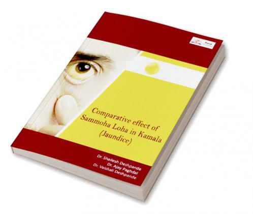Comparitive Effect of Sammoha Loha Vati in Kamala (Jaundice)