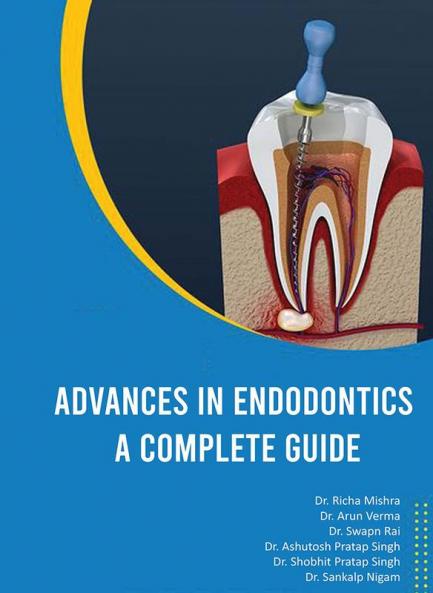 ADVANCES IN ENDODONTICS A COMPLETE GUIDE
