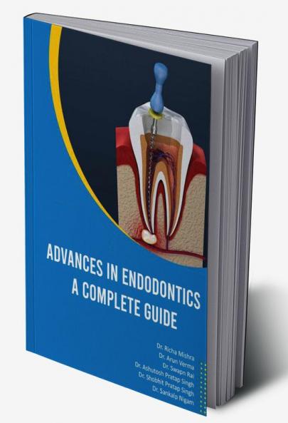 ADVANCES IN ENDODONTICS A COMPLETE GUIDE