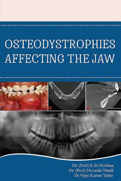 Osteodistrophies Affecting The Jaw