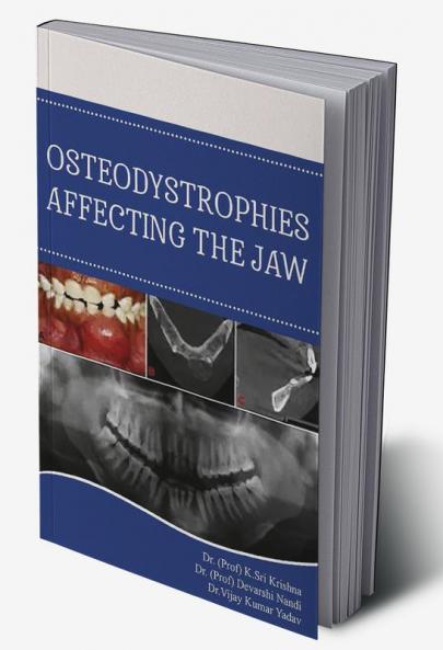 Osteodistrophies Affecting The Jaw