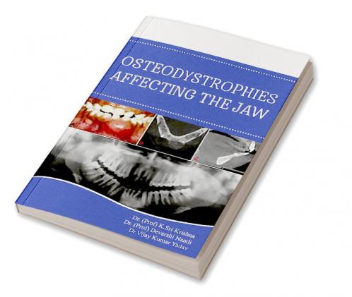 Osteodistrophies Affecting The Jaw