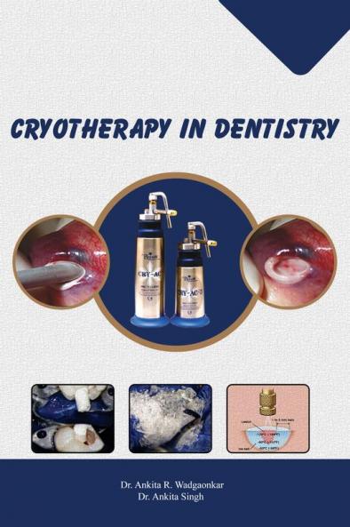 CRYOTHERAPY IN DENTISTRY