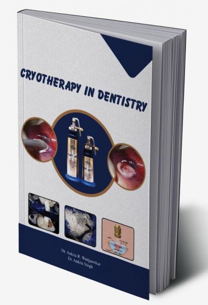 CRYOTHERAPY IN DENTISTRY
