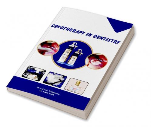CRYOTHERAPY IN DENTISTRY