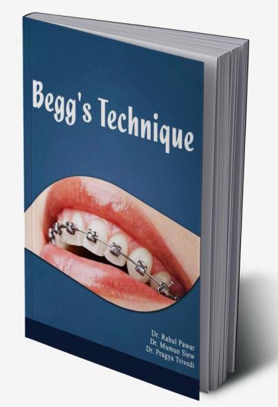 Begg's Technique