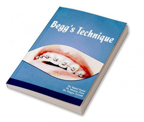 Begg's Technique