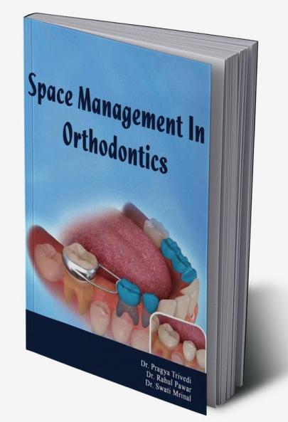 SPACE MANAGEMENT IN ORTHODONTICS