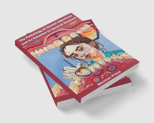 The Pathology of Dental Infections and Its Relation to General Diseases
